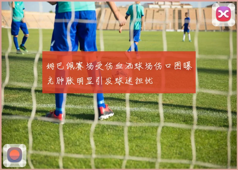 姆巴佩赛场受伤血洒球场伤口图曝光肿胀明显引发球迷担忧